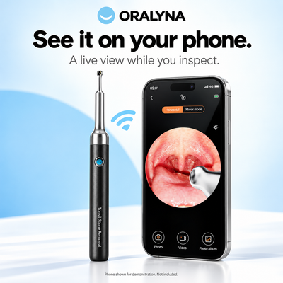 Oralyna Tonsil Stone Remover Kit